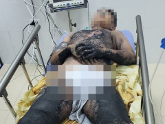 Ảnh bìa bài viết 717451