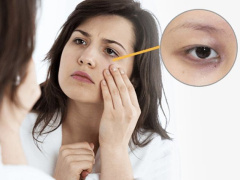 Ảnh bìa bài viết 719337