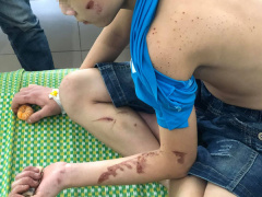 Ảnh bìa bài viết 719582