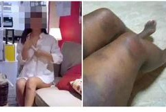 Ảnh bìa bài viết 720654