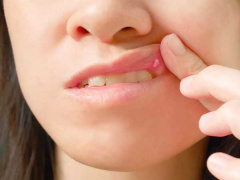 Ảnh bìa bài viết 722483