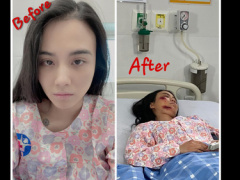Ảnh bìa bài viết 724208
