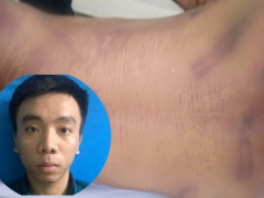 Ảnh bìa bài viết 724192