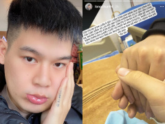 Ảnh bìa bài viết 725557
