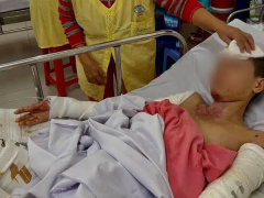 Ảnh bìa bài viết 725554