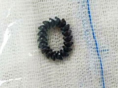 Ảnh bìa bài viết 725827