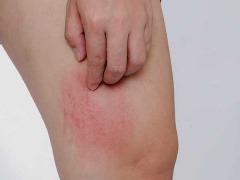 Ảnh bìa bài viết 730787
