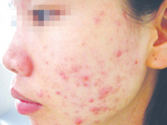 Ảnh bìa bài viết 731694
