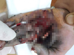 Ảnh bìa bài viết 731943