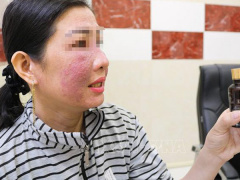 Ảnh bìa bài viết 732130