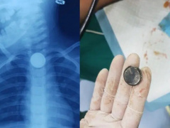 Ảnh bìa bài viết 733054