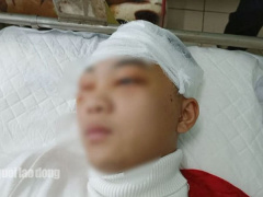 Ảnh bìa bài viết 733778