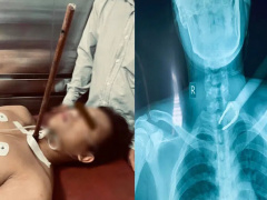 Ảnh bìa bài viết 737118
