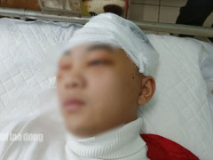 Ảnh bìa bài viết 741508