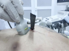 Ảnh bìa bài viết 745152