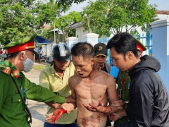 Ảnh bìa bài viết 746794