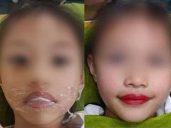 Ảnh bìa bài viết 750931