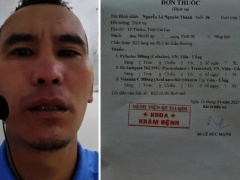 Ảnh bìa bài viết 751254