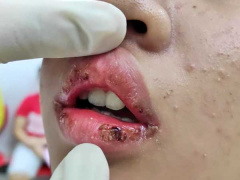Ảnh bìa bài viết 754668
