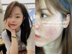 Ảnh bìa bài viết 760419