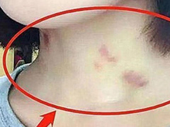 Ảnh bìa bài viết 760452
