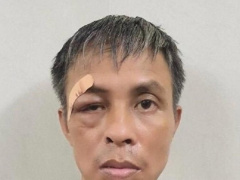 Ảnh bìa bài viết 763606