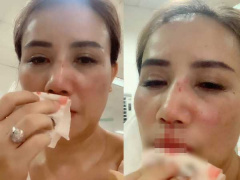 Ảnh bìa bài viết 766909