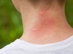 Ảnh bìa bài viết 769185