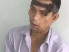 Ảnh bìa bài viết 774275
