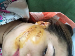 Ảnh bìa bài viết 775256