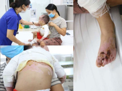 Ảnh bìa bài viết 778613