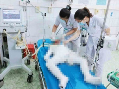 Ảnh bìa bài viết 787329