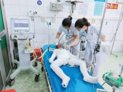 Ảnh bìa bài viết 787269