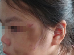 Ảnh bìa bài viết 788251