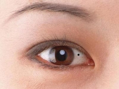 Ảnh bìa bài viết 794162