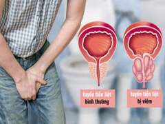 Ảnh bìa bài viết 794069