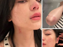 Ảnh bìa bài viết 794492