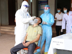 Ảnh bìa bài viết 798554