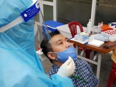 Ảnh bìa bài viết 798559