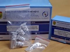 Ảnh bìa bài viết 801852