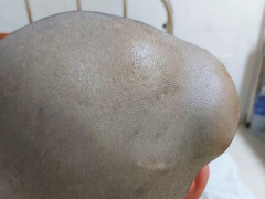 Ảnh bìa bài viết 804314