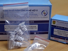 Ảnh bìa bài viết 805608