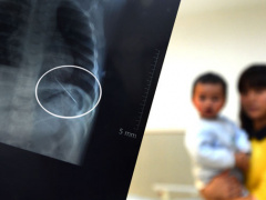 Ảnh bìa bài viết 806250