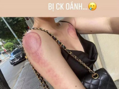 Ảnh bìa bài viết 814015