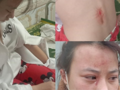 Ảnh bìa bài viết 815601