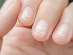Ảnh bìa bài viết 817115