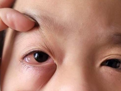 Ảnh bìa bài viết 817988