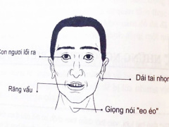 Ảnh bìa bài viết 819962