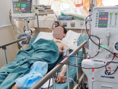 Ảnh bìa bài viết 821649