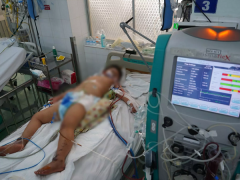 Ảnh bìa bài viết 824675